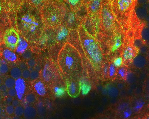 Image of dividing neural stem cells by alum Gerson Ascencio (B.S., ’21; M.S. ’23)