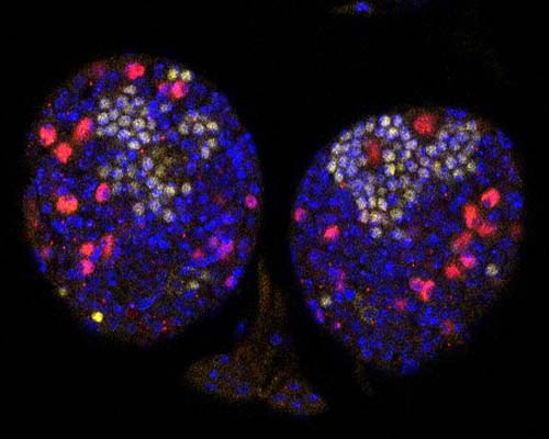 Immunostaining of fruit fly (drosophila) larval brain by alum Stephanie Uzordinma Awuzie (M.S. ’25).